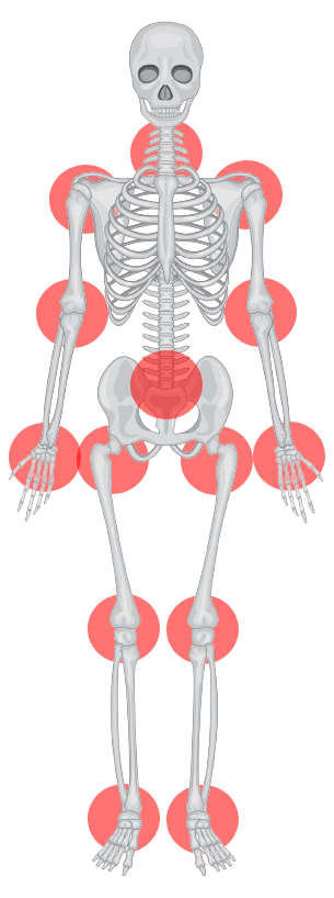 sitas reikalingas skeltas